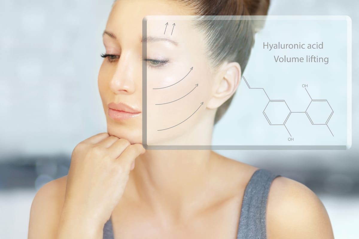 Ácido hialurónico