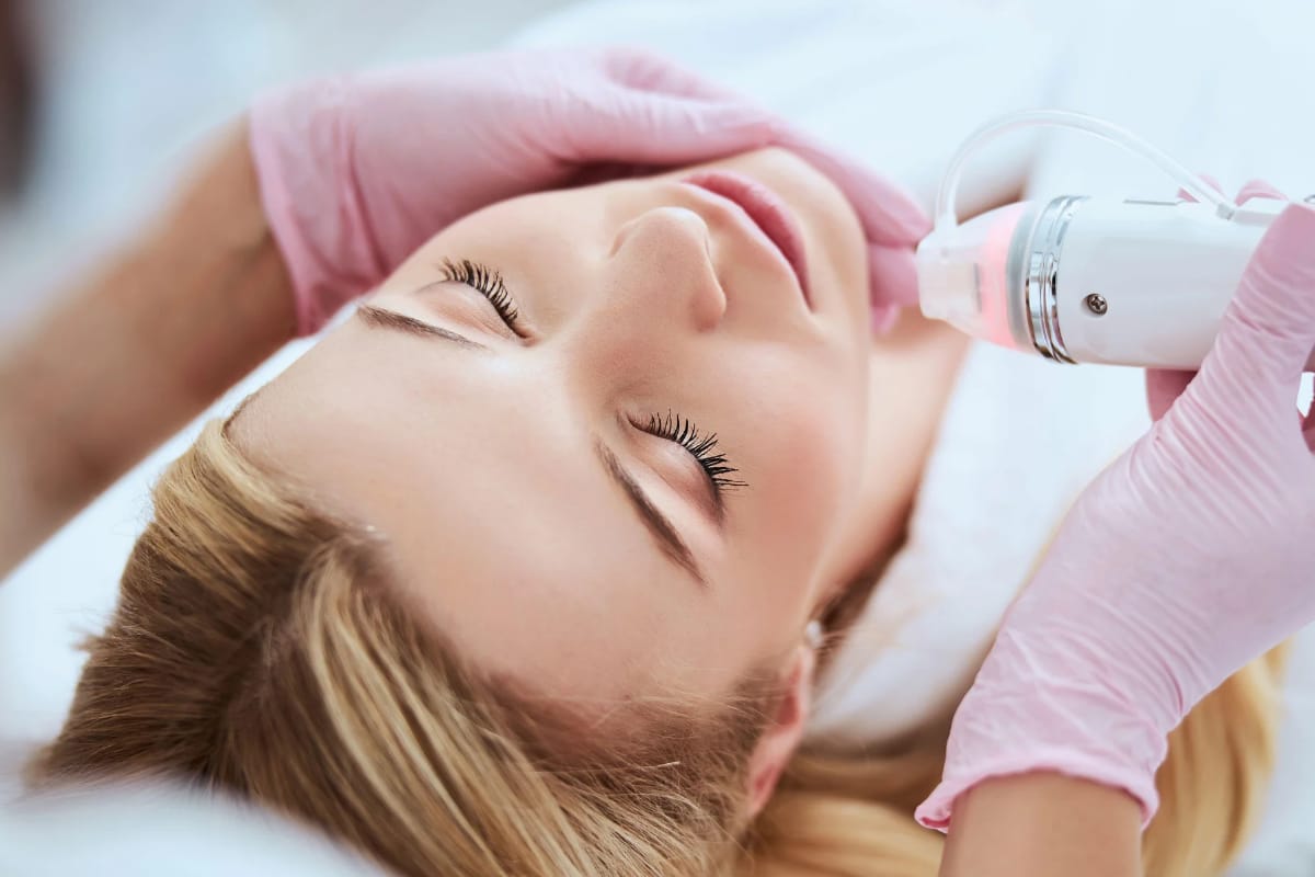 Radiofrecuencia fraccionada